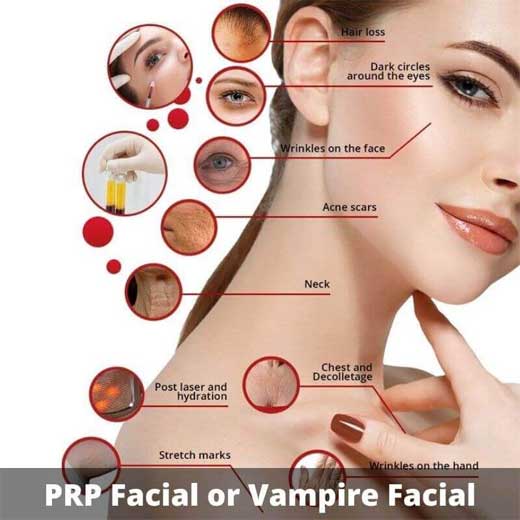 Ενέσεις πλάσματος,(PRP)